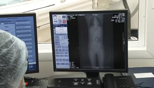 Сотни случаев за год: на Алтае у детей все чаще находят мочекаменные болезни