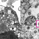Гонконгские ученые опубликовали фото омикрон-штамма коронавируса