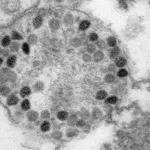Попова: новый штамм коронавируса больше не поражает легкие