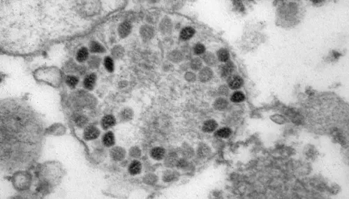 Попова: новый штамм коронавируса больше не поражает легкие