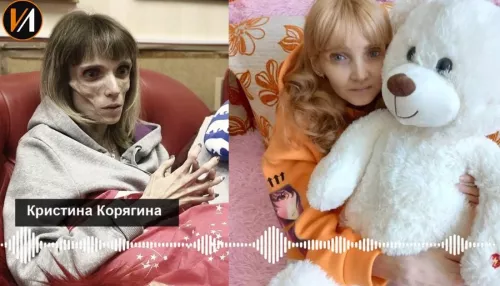 Больная анорексией жительница Барнаула устроилась на работу