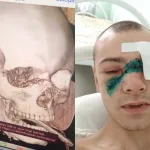 На стройке в Шерегеше рабочему болгарка разрезала лицо и лишила глаза