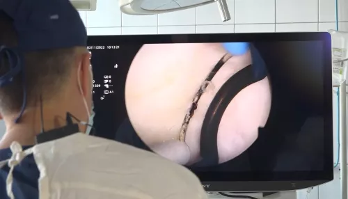 Алтайские врачи-урологи провели уникальную операцию на аденоме простаты