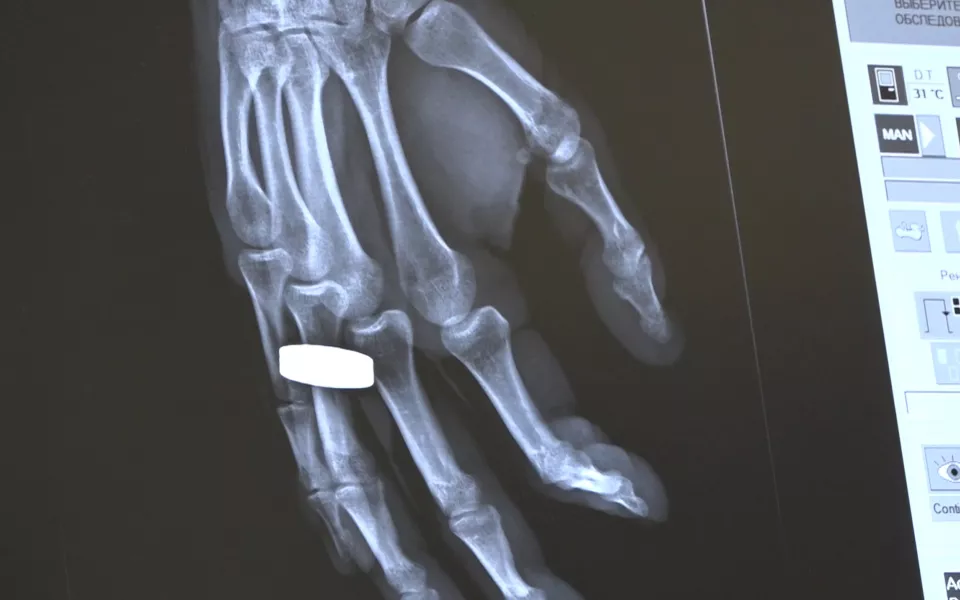 В барнаульской поликлинике 7 появился современный цифровой рентген