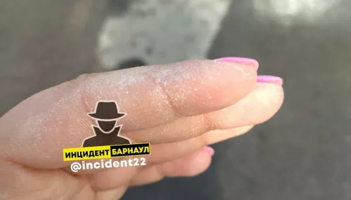 Жительница Барнаула получила ожог после похода в Ozon