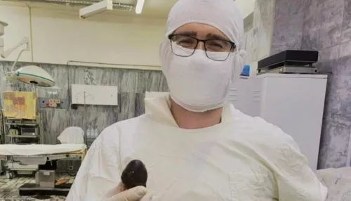 Сибирские врачи удалили пенсионерке камень размером с куриное яйцо
