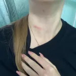 Недостаточно побоев: медсестра из Барнаула рассказала о нападении пациента