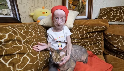 Душа компании и блогер. Как живет юная сибирячка с синдромом стремительного старения