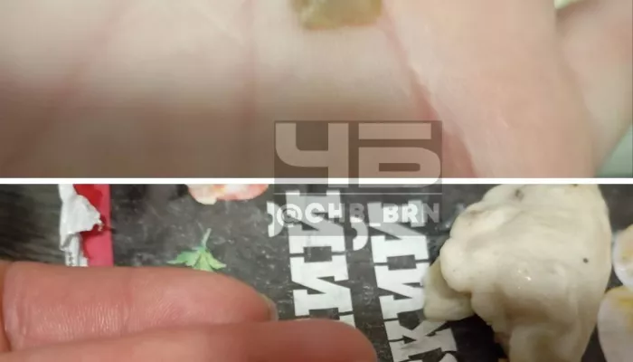 Жительница Барнаула нашла в варениках зуб, похожий на человеческий