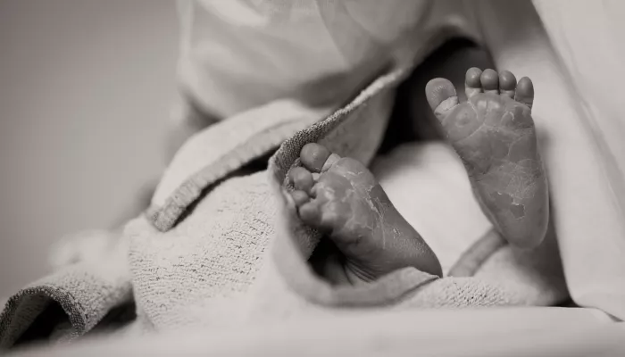 В Индии появился на свет младенец с двумя лицами и восемью руками и ногами