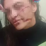 Незнакомец разбил стакан о лицо девушки в одном из баров Белокурихи