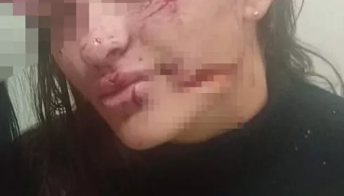 Незнакомец разбил стакан о лицо девушки в одном из баров Белокурихи