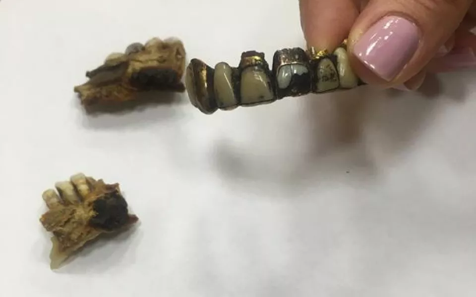 В архиве ФСБ России показали челюсть Адольфа Гитлера