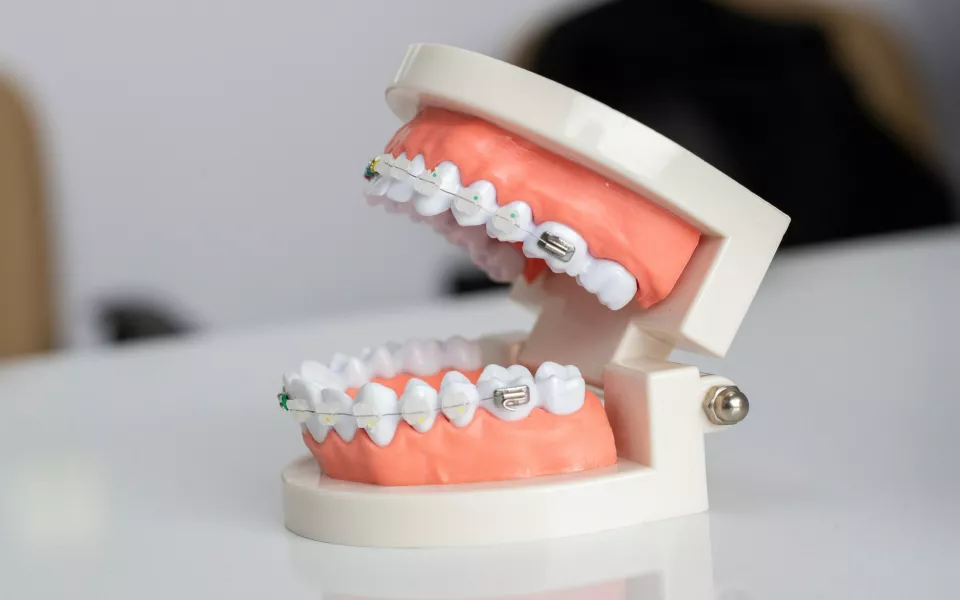 Оскал капитализма: почему брекеты такие дорогие и откуда у детей много проблем во рту