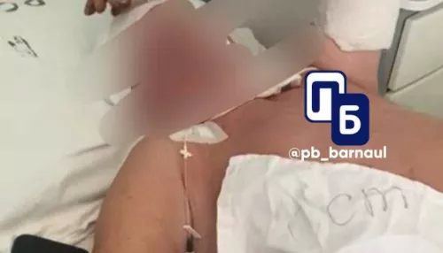 Переломы рук, пробита голова: пенсионера избили в Барнауле