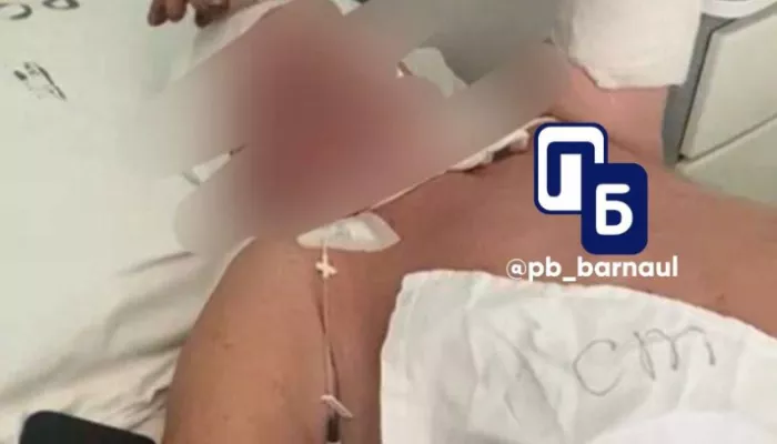 Переломы рук, пробита голова: пенсионера избили в Барнауле