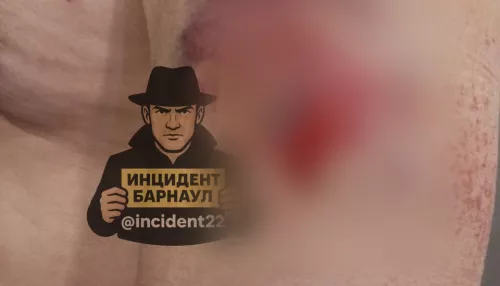 Соцсети: туристы из Сочи стреляли в дальнобойщика в Сростках