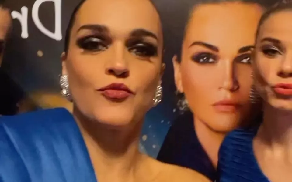 Слава рассказала о тяжелой реакции на бьюти-процедуры и показала новые губы. Фото