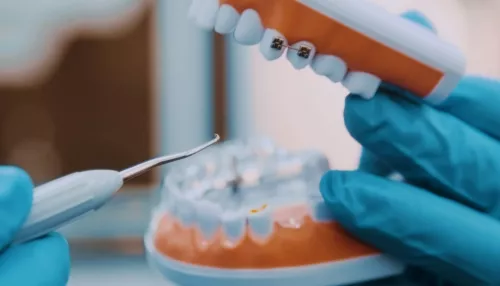 Четырехлетняя девочка умерла после лечения 18 зубов за раз под наркозом