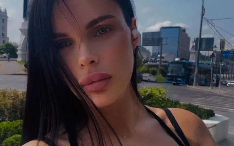 Модель без части черепа борется за жизнь: Анжелике Тартановой требуется помощь