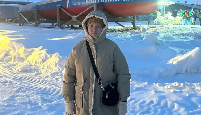 Картункова откровенно рассказала о жизни с протезом и внезапном похудении на 80 кг