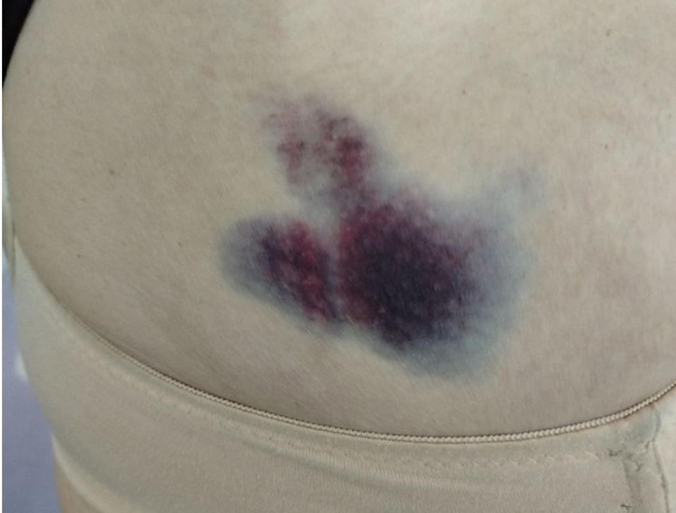 Последствия удара