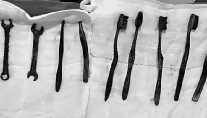 Из желудка мужчины извлекли семь зубных щеток и два гаечных ключа