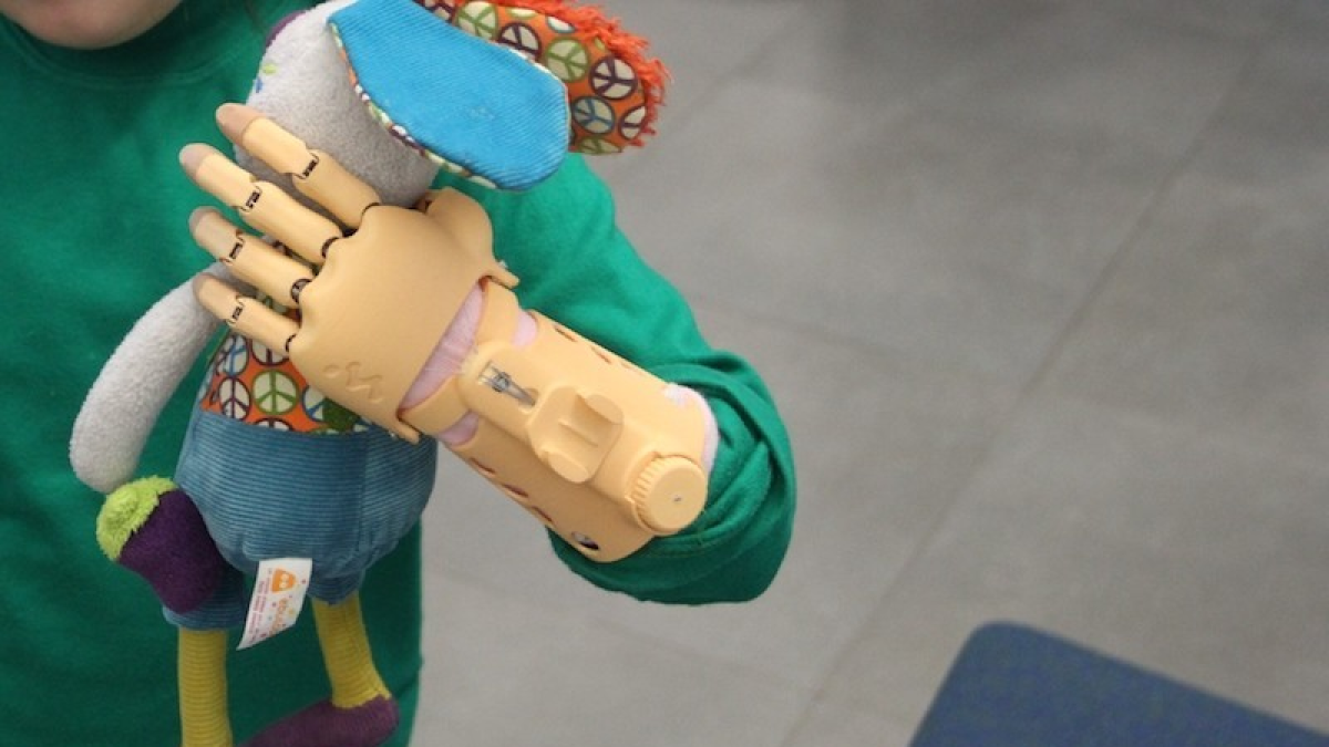 Дети из Алтайского края смогут бесплатно получить ручной протез