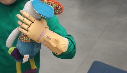 Дети из Алтайского края смогут бесплатно получить ручной протез