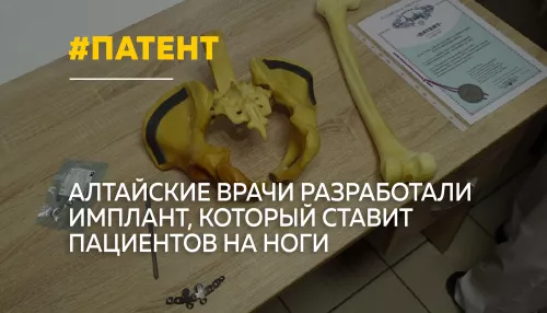 Барнаульские травматологи получили патент на имплант для лечения переломов таза