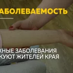 Палаты переполнены: в Алтайском крае растет заболеваемость кожными болезнями