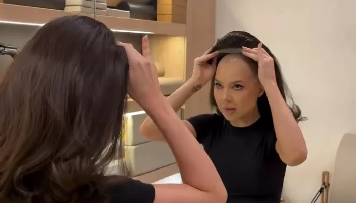 Друг показал, как Лерчек выглядит после очередной химиотерапии. Честные фото