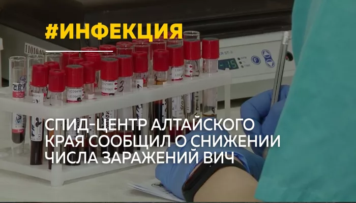 В Алтайском крае снижается число новых случаев ВИЧ-инфекции