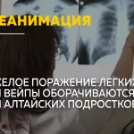 От вейпа до реанимации: алтайские врачи предупредили об опасном заболевании легких