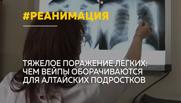 От вейпа до реанимации: алтайские врачи предупредили об опасном заболевании легких