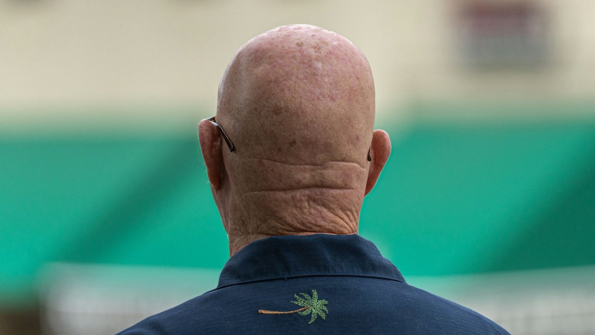 Лысый мужчина