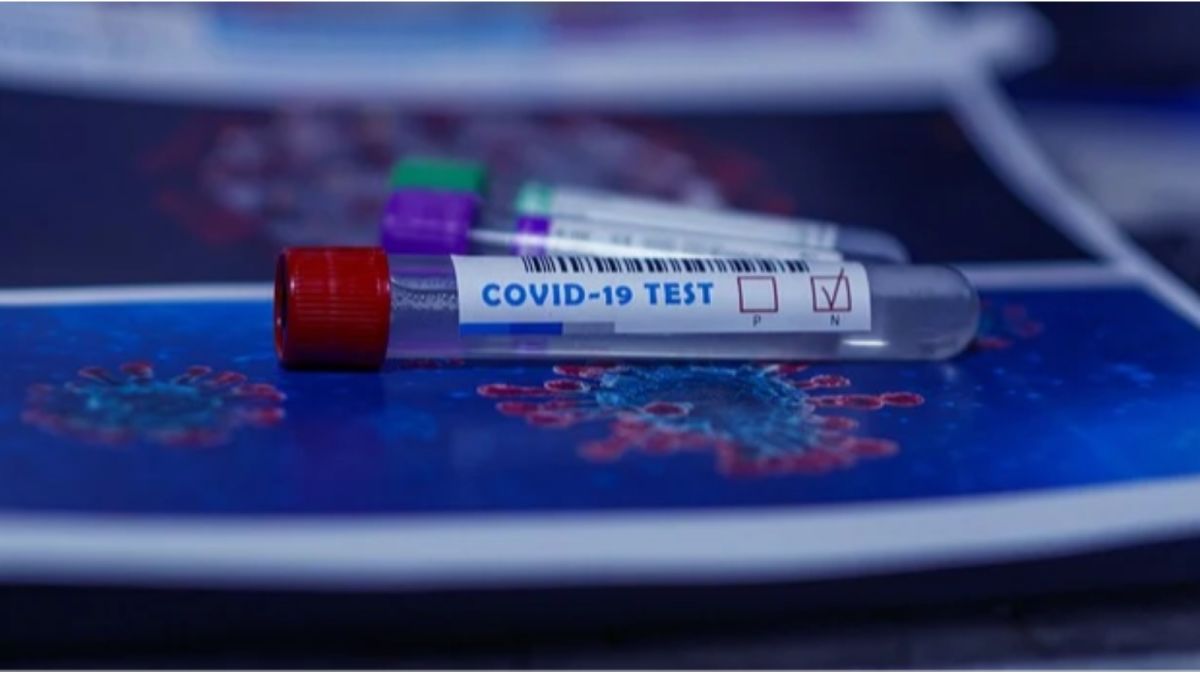 Биолог объяснила, почему ошибаются тесты на COVID-19