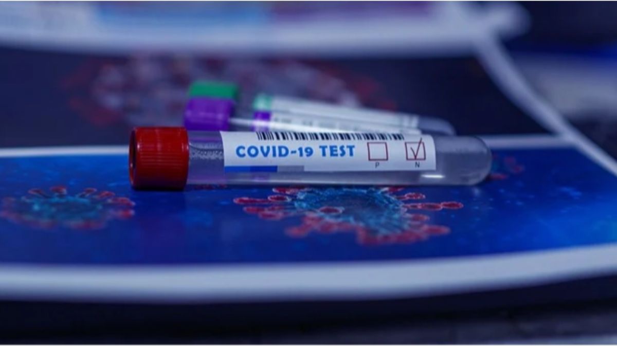 Вирусолог назвала особенности теста на антитела к COVID-19