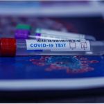 Вирусолог назвала особенности теста на антитела к COVID-19