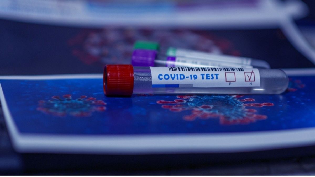 Стоит ли проводить тест на антитела к коронавирусу и где это сделать в Барнауле?
