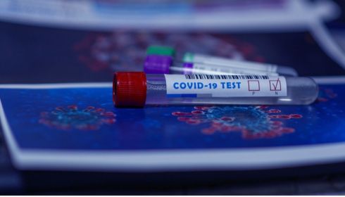 Стоит ли проводить тест на антитела к коронавирусу и где это сделать в Барнауле?