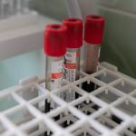 Пять смертей и 62 заболевших: обновилась статистика по коронавирусу за сутки