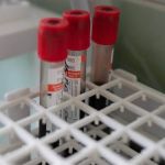 Роспотребнадзор: половина больных COVID детей перенесла его в легкой форме