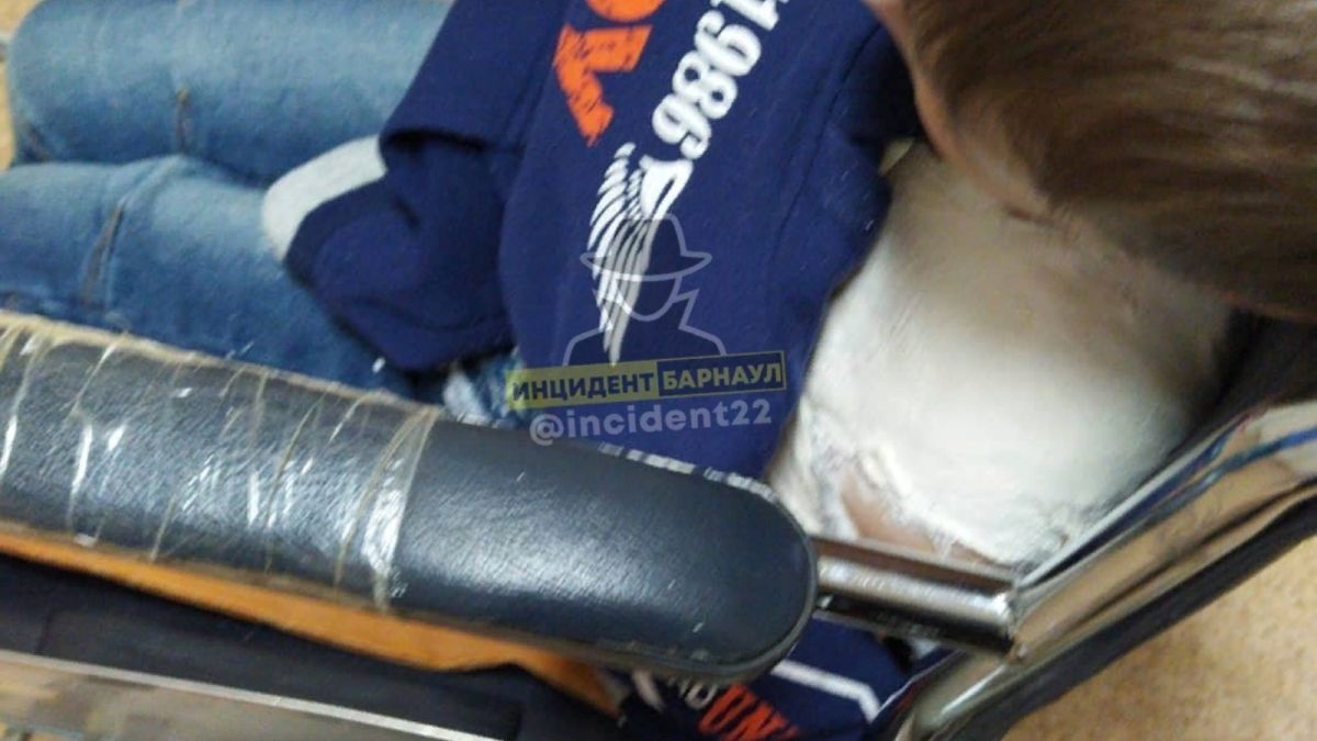 Ребенку из Бийска с закрытым переломом не могут сделать операцию из-за ковида