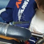 Ребенку из Бийска с закрытым переломом не могут сделать операцию из-за ковида