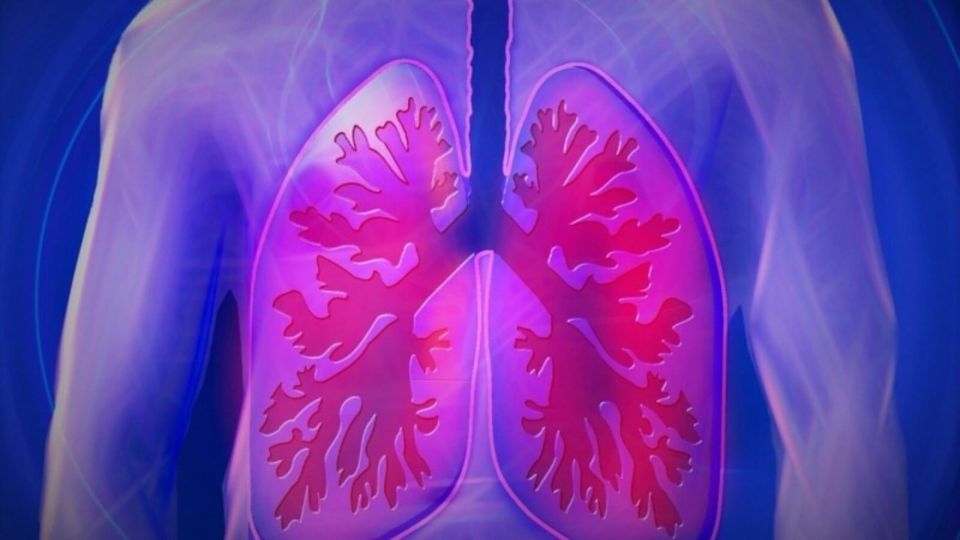 В минздраве из-за очередей на КТ решили выявлять пневмонию на обычных рентгенах