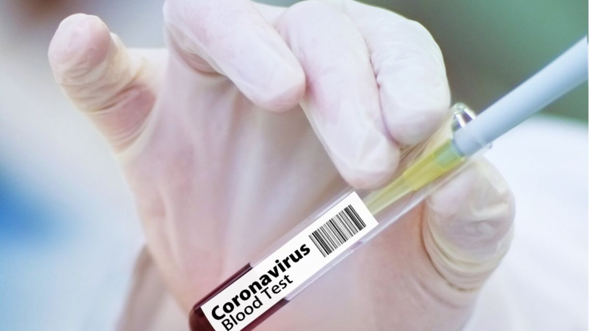 114 человек заболели, 8 умерли: коронавирусная статистика на Алтае на 6 октября