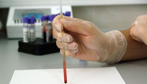 Бактерия или вирус? Как расшифровать общий анализ крови и зачем его делать