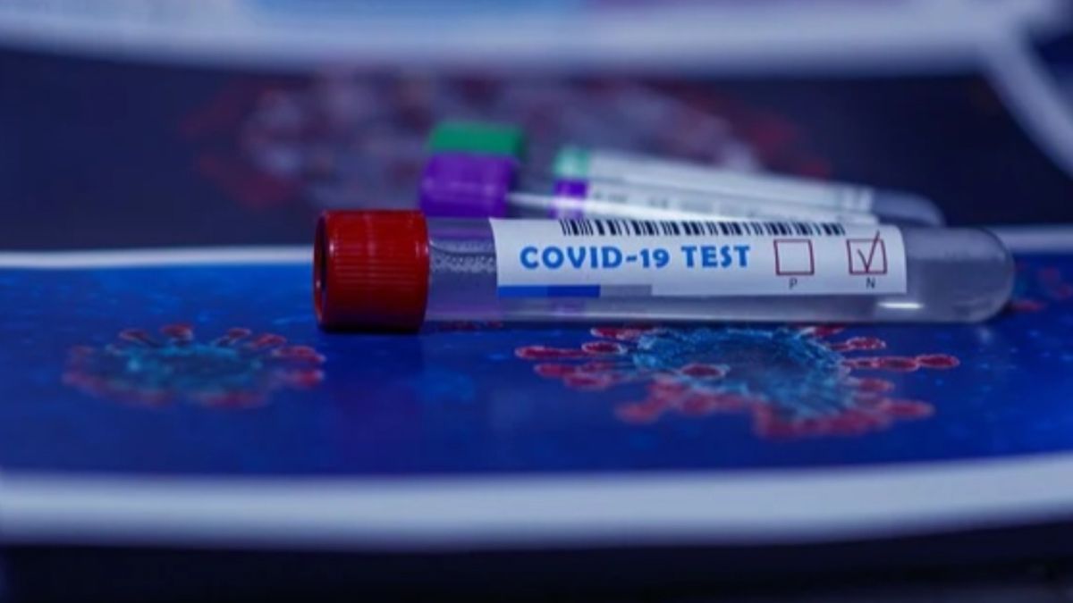 Врач рассказал, кто может попасть в "серую зону" тестов на антитела к COVID 