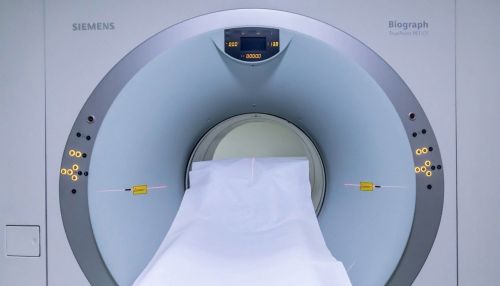 Компьютерный томограф починили в каменской больнице